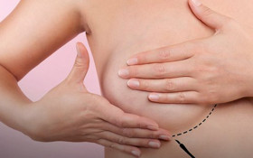 Outubro Rosa: Mamografia dos 30 aos 70 anos, veja o que muda no exame em cada idade