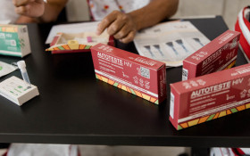 Pesquisa brasileira registra avan&ccedil;os promissores rumo &agrave; cura do HIV