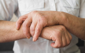 S&atilde;o Paulo reduz hansen&iacute;ase em 32% e atinge meta da OMS