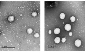 Estudo da UnB est&aacute; desenvolvendo uma t&eacute;cnica para tratar o melanoma