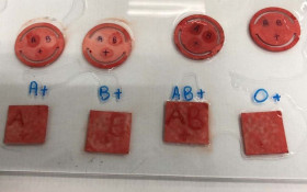 Paran&aacute; testa curativo que identifica tipo sangu&iacute;neo