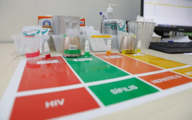 DF triplica o uso de profilaxia contra o HIV e supera a meta nacional