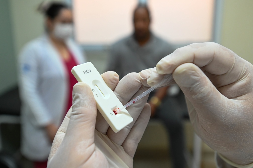 Campinas acende alerta para hepatites B e C no Julho Amarelo