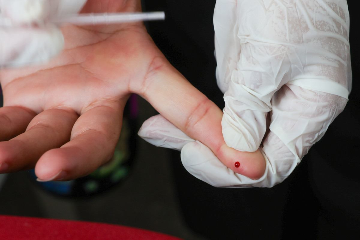 SUS adquiretecnologia paraproduzir principalrem&eacute;dio contra o HIV