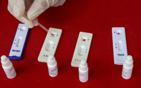 Estudo sobre hepatites virais tra&ccedil;a panorama da doen&ccedil;a em onze anos