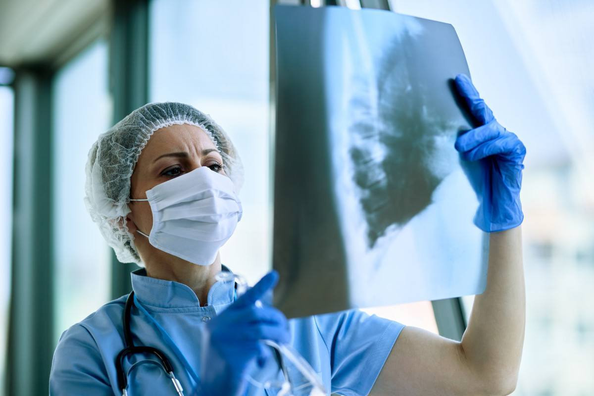 Capital paulista registra 3,4 mil casos de tuberculose