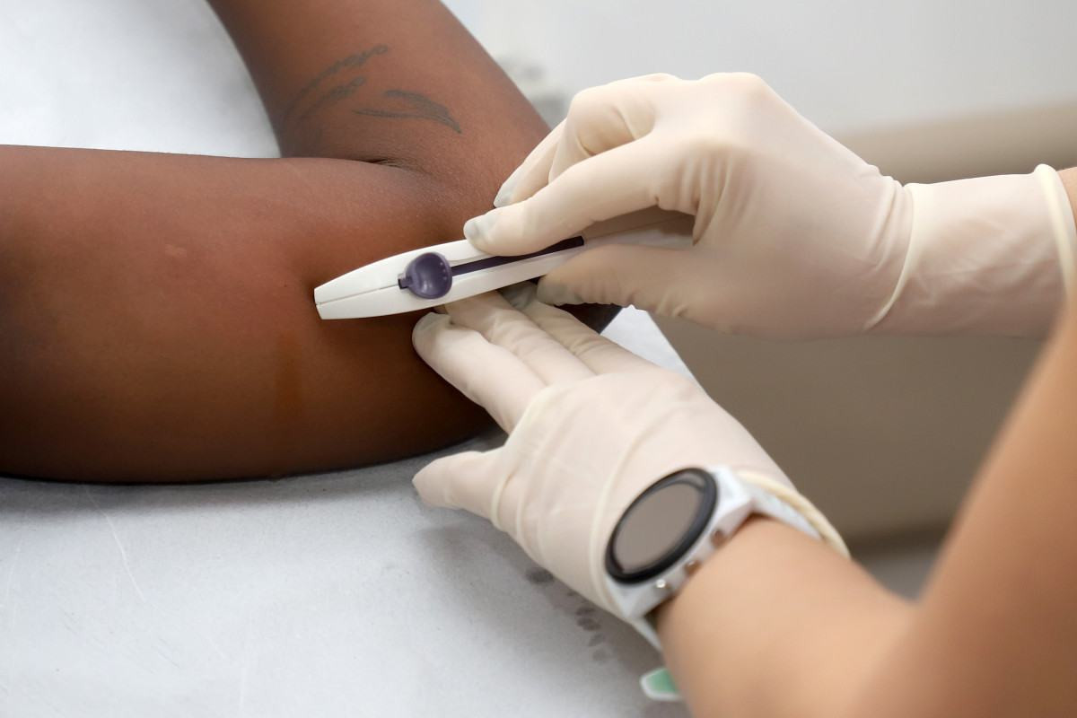 Ades&atilde;o ao implante anticoncepcional cresce 553% em Campinas ap&oacute;s ser incorporado ao SUS pelo Minist&eacute;rio da Sa&uacute;de