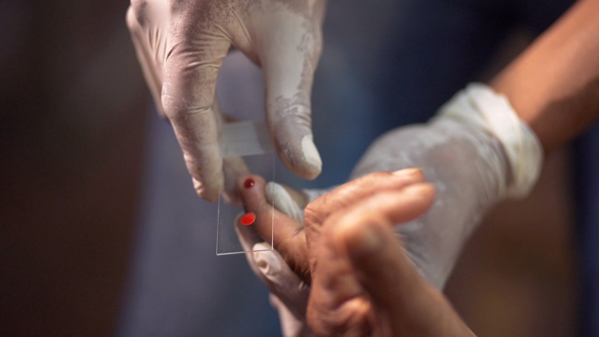 Mal&aacute;ria: Anvisa autoriza teste em humanos de vacina brasileira